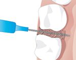 Eine Interdentalzahnbürste Eine Interdentalzahnbürste